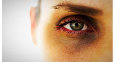 6 علتی که دور چشم های شما را مانند ذغال سیاه می کنند