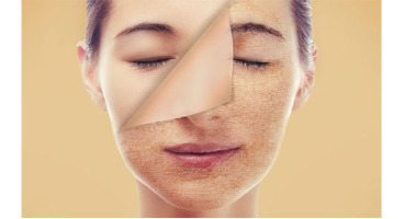 ۷ دشمن سلامتی پوست را بشناسید