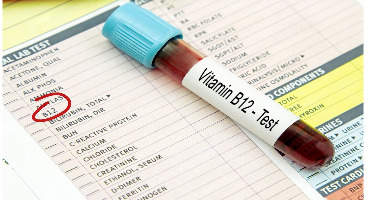 تشخیص کمبود ویتامین B۱۲ بدون آزمایش
