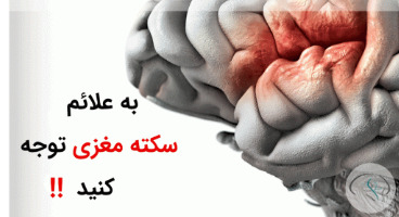 نکاتی مهم برای پیشگیری از سکته مغزی که باید بدانید 